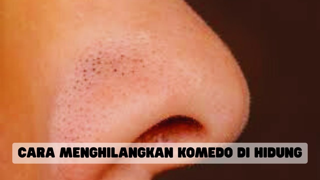 Cara Menghilangkan Komedo di Hidung